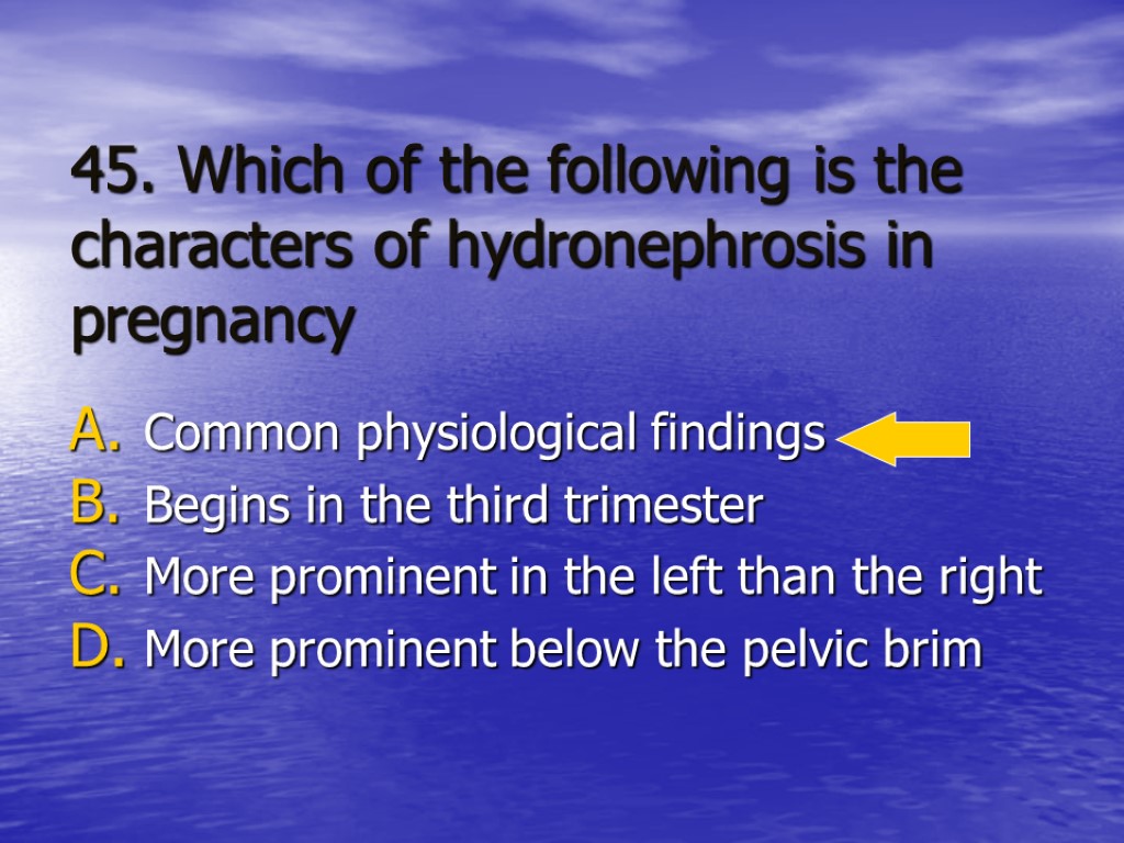 45. Which of the following is the characters of hydronephrosis in pregnancy Common physiological